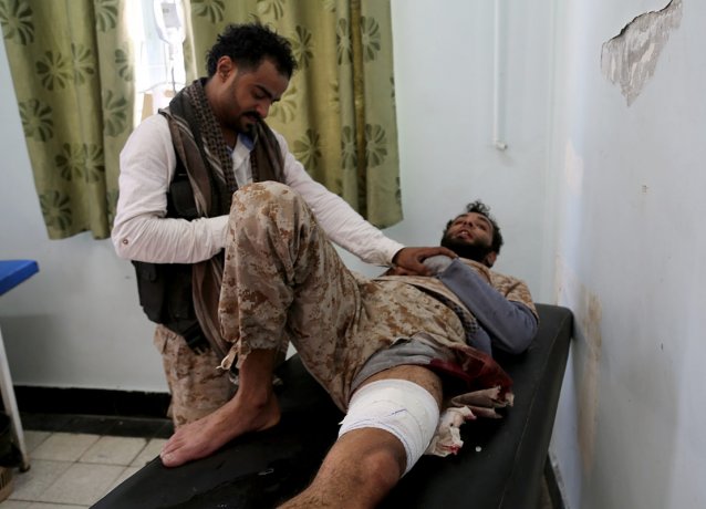 ООН: За 9 месяцев в Йемене убито около 1500 мирных жителей