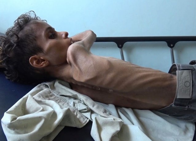 Йемен: Глава ООН предупредил о неминуемой опасности голода