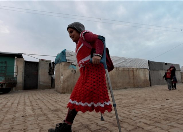Маленькая сирийка, лишившаяся ноги при бомбежке, ждет помощи