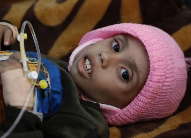 ООН: Внесение хуситов в черный список приведет к голодной смерти сотен тысяч людей в Йемене