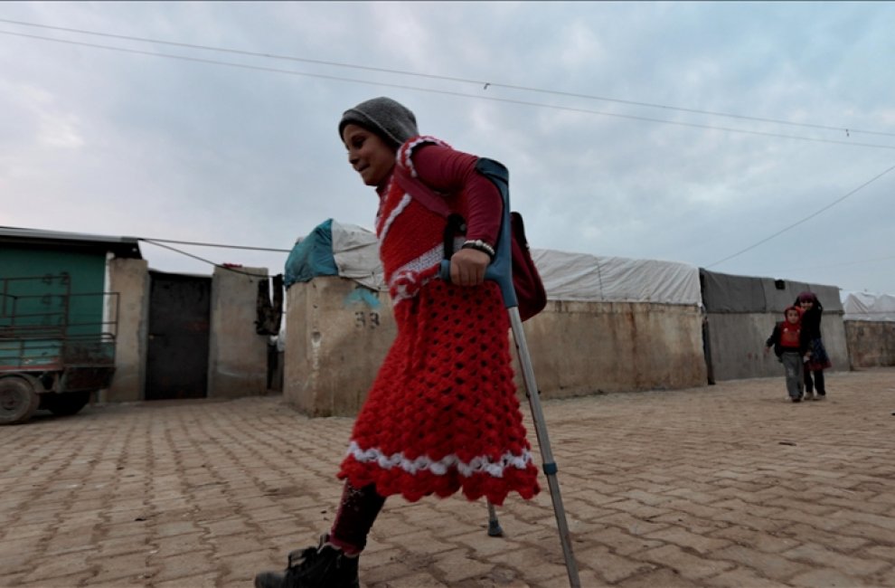Маленькая сирийка, лишившаяся ноги при бомбежке, ждет помощи