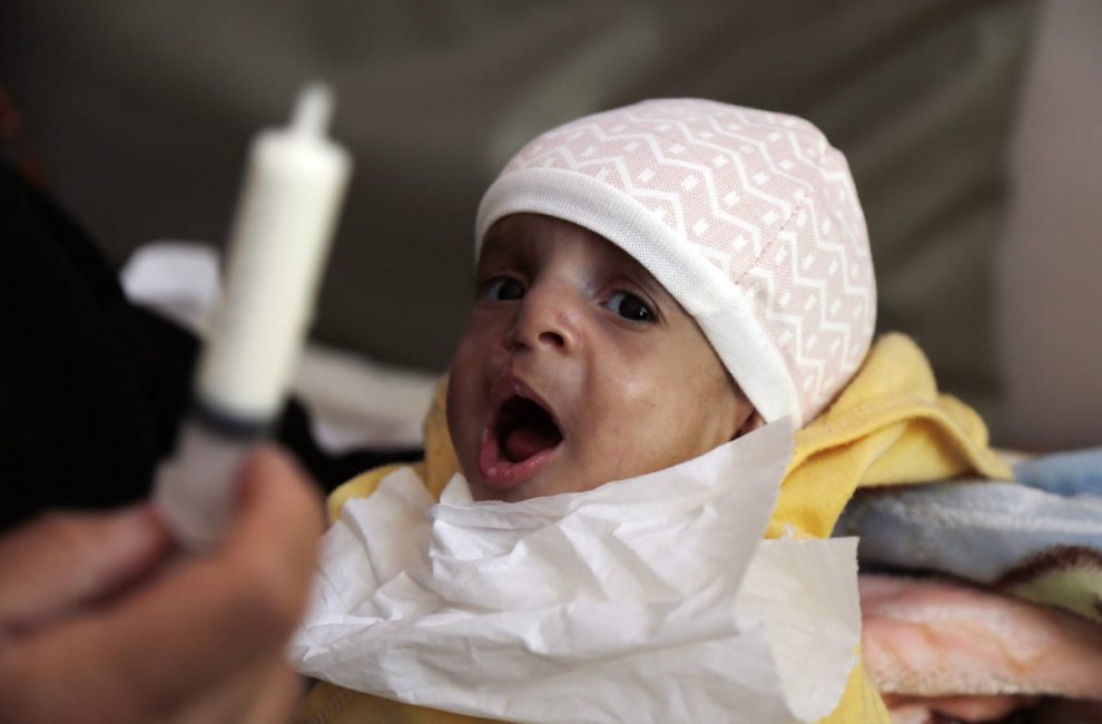 ООН: В этом году от голода могут умереть не менее 400 тысяч йеменских детей младше 5 лет